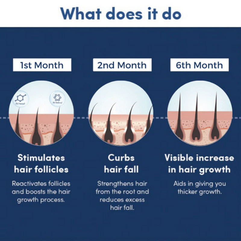 Buy Redensyl Procapil Hair Growth Tonic (60ml) Man Matters